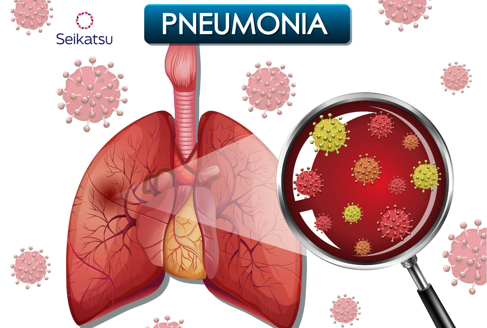 Pneumonia